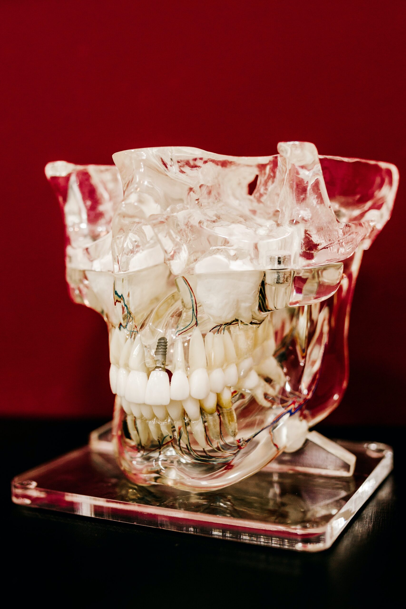 Addressing Bite Alignment: Orthodontic Benefits of Dental Implants